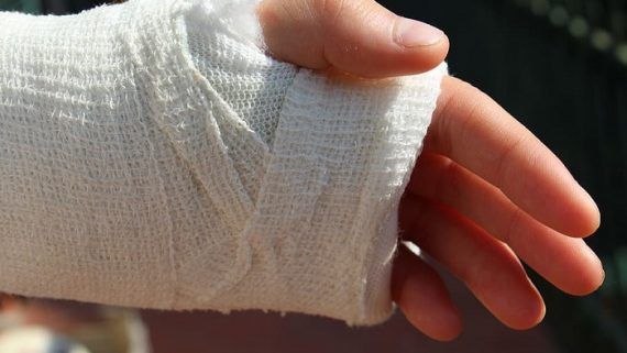 Los puntos de aproximación y el delito grave de lesiones